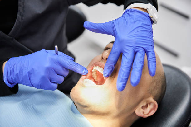 Best Emergency Treatment for Dental Infections or Abscesses in Lake Sarasota, FL