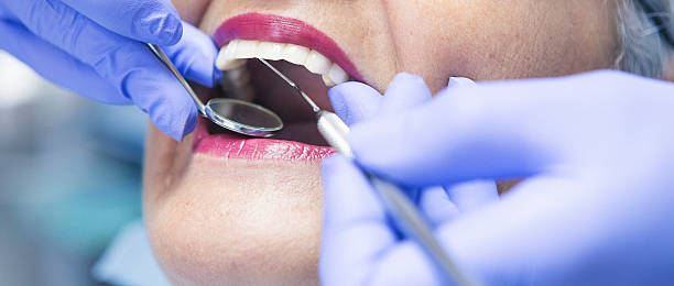 Best Cosmetic Emergency Dentistry in Lake Sarasota, FL